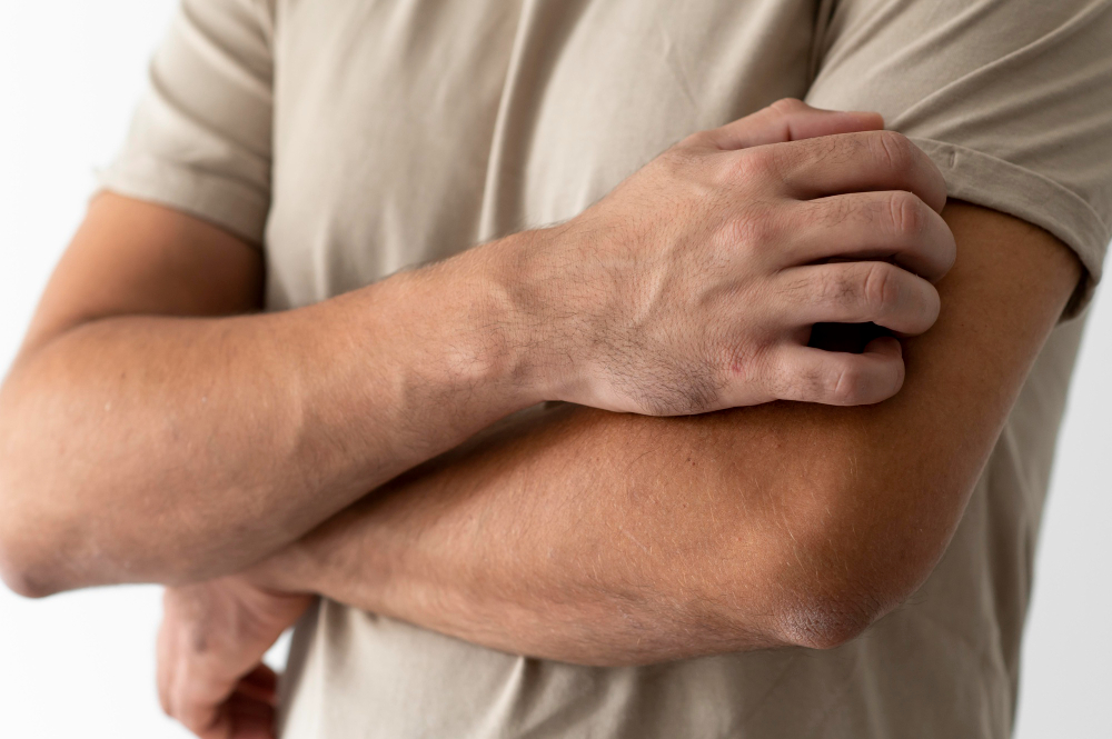 Como evitar alergia no frio? 2 Alergia pele