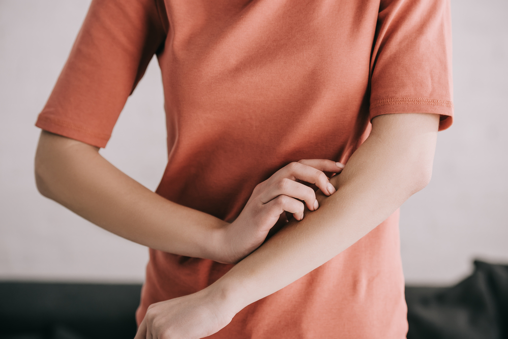 Como evitar alergia no frio? 3 coceira alergia